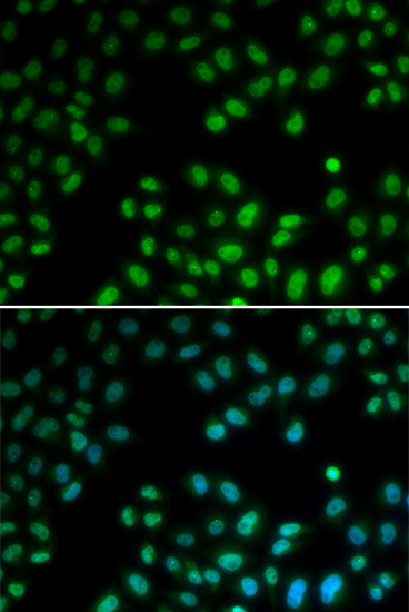 Immunofluorescence - PIAS1 Polyclonal Antibody 