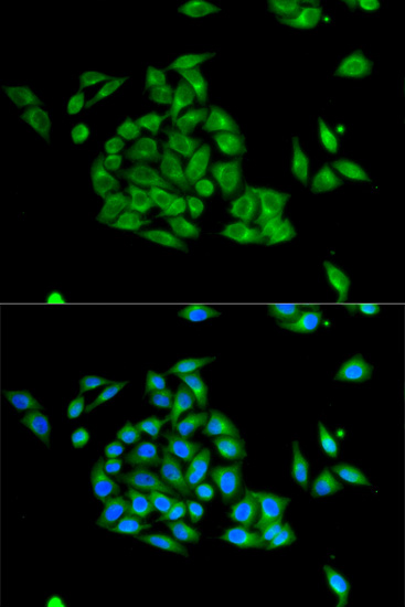 Immunofluorescence - PICK1 Polyclonal Antibody 