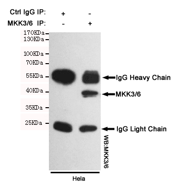Immunoprecipitation analysis of Hela cell lysates using MKK3/6 mouse mAb.