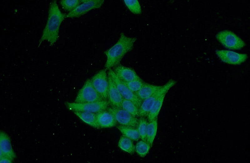 Immunofluorescent analysis of HeLa cells using Catalog No:114967(S100P Antibody) at dilution of 1:50 and Alexa Fluor 488-congugated AffiniPure Goat Anti-Rabbit IgG(H+L)