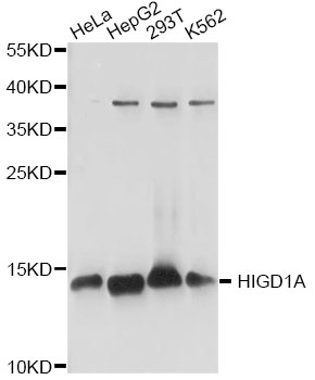 Western blot - HIGD1A Polyclonal Antibody 