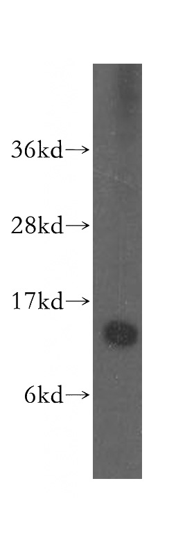 HEK-293 cells were subjected to SDS PAGE followed by western blot with Catalog No:115460(SNRPD1 antibody) at dilution of 1:500