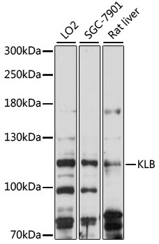 Western blot - KLB Polyclonal Antibody 