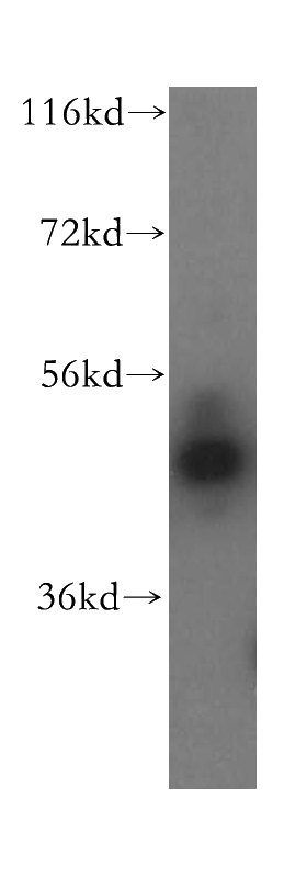 HeLa cells were subjected to SDS PAGE followed by western blot with Catalog No:109795(KRT16 antibody) at dilution of 1:500