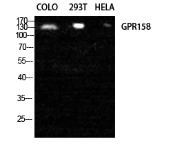 Fig1:; Western Blot analysis of COLO 293T HELA cells using GPR158 Polyclonal Antibody diluted at 1: 2000