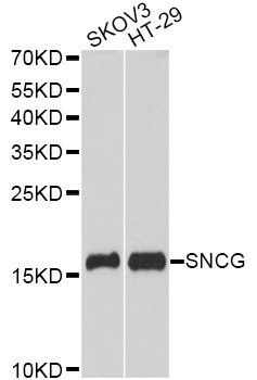 Western blot - SNCG Polyclonal Antibody 