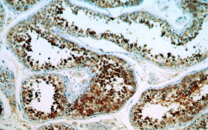 Immunohistochemical of paraffin-embedded human testis using Catalog No:108817(CALCocO1 antibody) at dilution of 1:100 (under 10x lens)