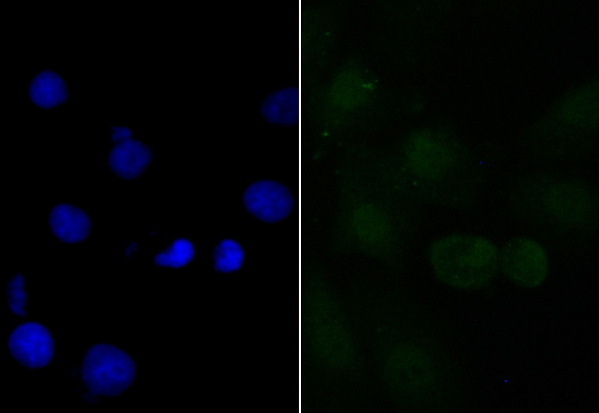 Fig2: ICC staining APR3 in A549 cells (green). The nuclear counter stain is DAPI (blue). Cells were fixed in paraformaldehyde, permeabilised with 0.25% Triton X100/PBS.