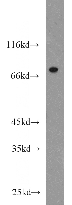 HeLa cells were subjected to SDS PAGE followed by western blot with Catalog No:109601(CSNK1A1L antibody) at dilution of 1:1000