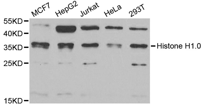 Western blot - Histone H1.0 Polyclonal Antibody 