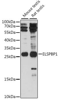 Western blot - ELSPBP1 Polyclonal Antibody 