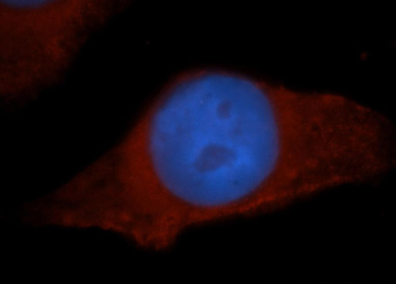 Immunofluorescent analysis of MCF-7 cells, using HPS5 antibody Catalog No:111454 at 1:50 dilution and Rhodamine-labeled goat anti-rabbit IgG (red). Blue pseudocolor = DAPI (fluorescent DNA dye).