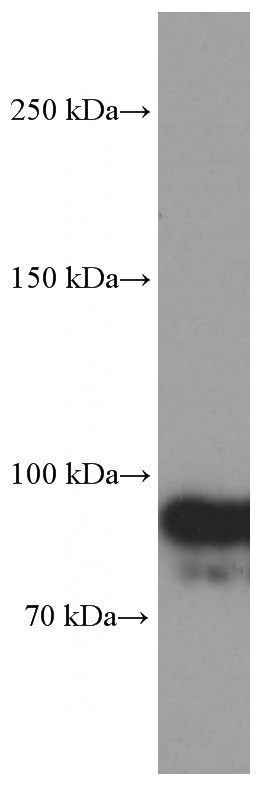 Jurkat cells were subjected to SDS PAGE followed by western blot with Catalog No:107439(OTUD7B Antibody) at dilution of 1:1000