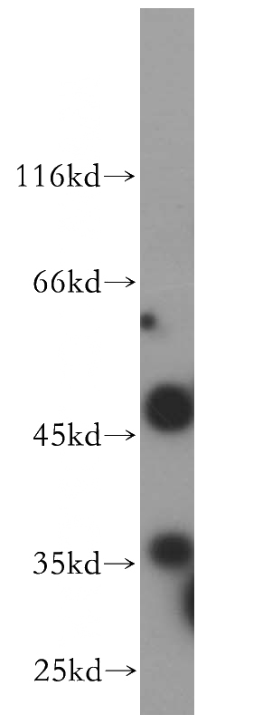 HeLa cells were subjected to SDS PAGE followed by western blot with Catalog No:109411(CLYBL antibody) at dilution of 1:600
