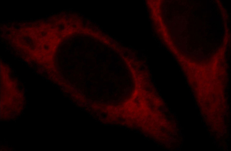 Immunofluorescent analysis of Hela cells, using CUEDC2 antibody Catalog No:109738 at 1:25 dilution and Rhodamine-labeled goat anti-rabbit IgG (red).