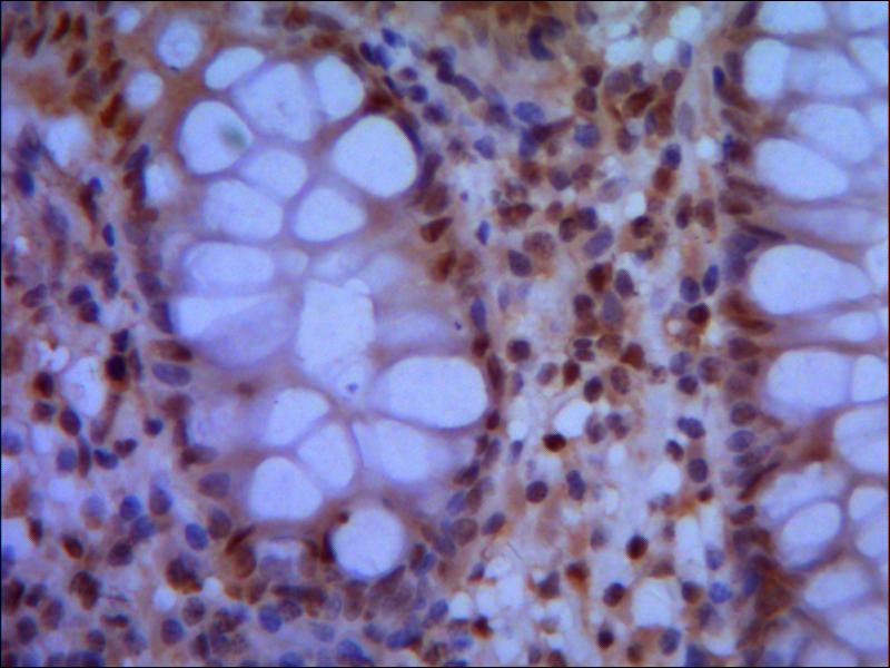 IHC of paraffin-embedded human colon using anti-SMC1A (N-terminus) mouse mAb diluted 1/500-1/1000.