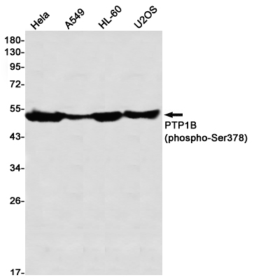 Western blot detection of PTP1B (phospho-Ser378) in Hela,A549,HL-60,U2OS using PTP1B (phospho-Ser378) Rabbit mAb(1:1000 diluted)