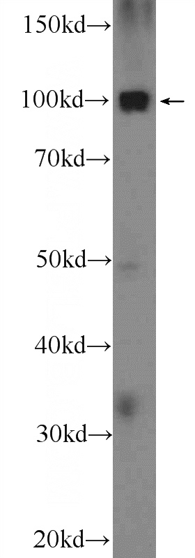 HEK-293 cells were subjected to SDS PAGE followed by western blot with Catalog No:115739(STT3A Antibody) at dilution of 1:300
