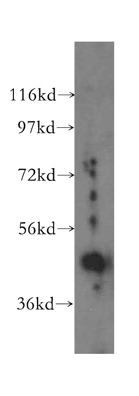 HEK-293 cells were subjected to SDS PAGE followed by western blot with Catalog No:112179(LDB1 antibody) at dilution of 1:400