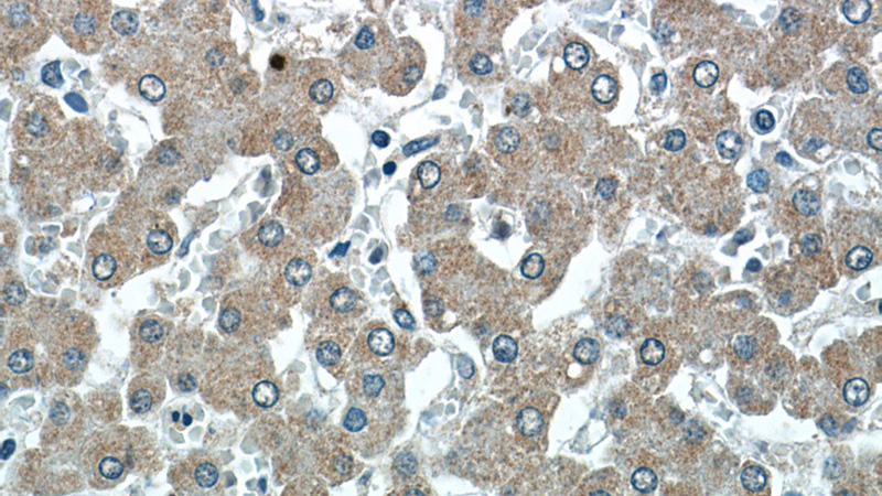 Immunohistochemistry of paraffin-embedded human liver slide using Catalog No:110886(GATC Antibody) at dilution of 1:50