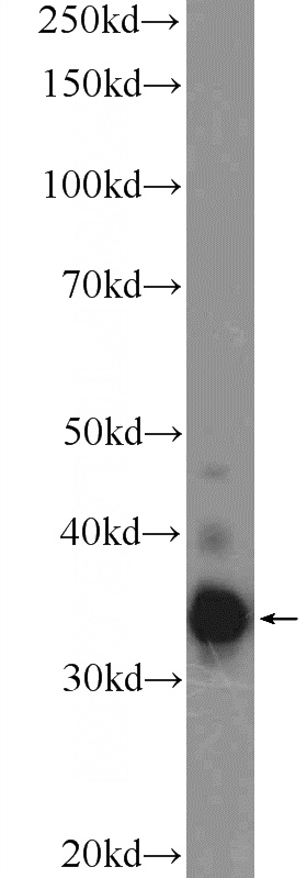 mouse testis tissue were subjected to SDS PAGE followed by western blot with Catalog No:115961(TEX264 Antibody) at dilution of 1:1000