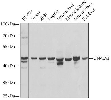 Western blot - DNAJA3 Polyclonal Antibody 