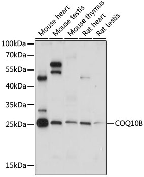 Western blot - COQ10B Polyclonal Antibody 