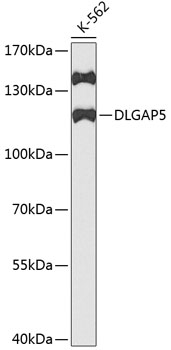 Western blot - DLGAP5 Polyclonal Antibody 