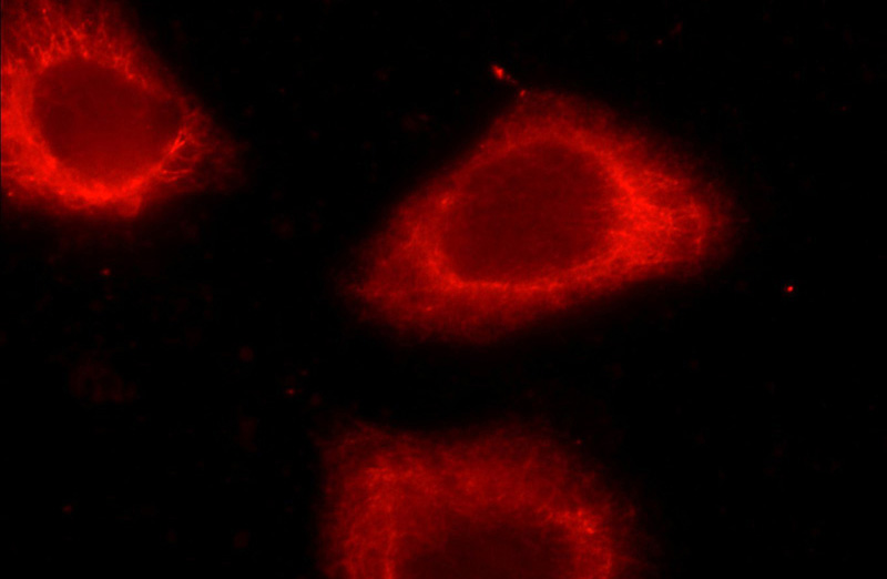Immunofluorescent analysis of HeLa cells using Catalog No:109809(KRT7 Antibody) at dilution of 1:25 and Rhodamine-Goat anti-Rabbit IgG