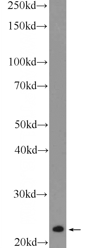 fetal human brain tissue were subjected to SDS PAGE followed by western blot with Catalog No:114461(RAB8B Antibody) at dilution of 1:1000