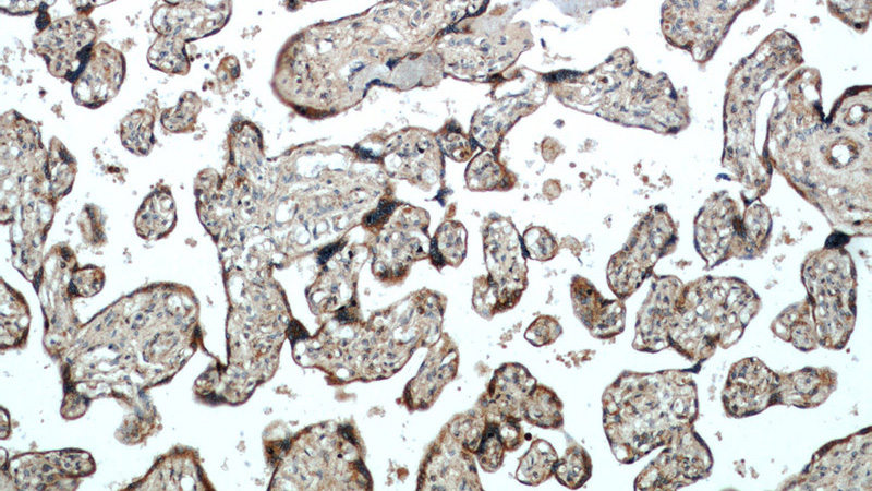 Immunohistochemical of paraffin-embedded human placenta using Catalog No:116081(TMC1 antibody) at dilution of 1:100 (under 10x lens)