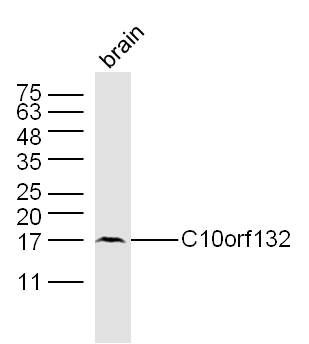 Fig1: Sample: Brain (Mouse) Lysate at 40 ug; Primary: Anti-C10orf132 at 1/300 dilution; Secondary: IRDye800CW Goat Anti-Rabbit IgG at 1/20000 dilution; Predicted band size: 18 kD; Observed band size: 18 kD