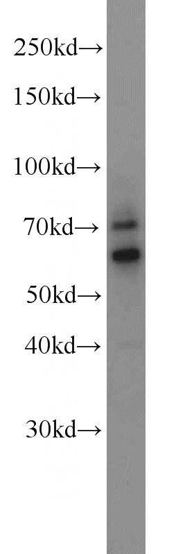 HL-60 cells were subjected to SDS PAGE followed by western blot with Catalog No:117159(ZNF311 antibody) at dilution of 1:4000