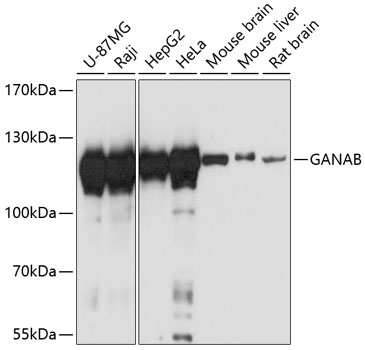 Western blot - GANAB Polyclonal Antibody 