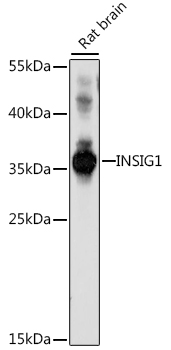 Western blot - INSIG1 Polyclonal Antibody 