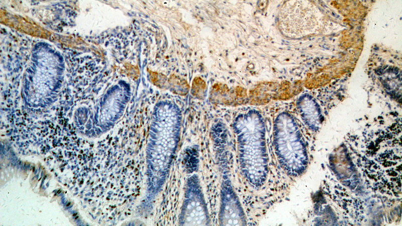 Immunohistochemical of paraffin-embedded human colon using Catalog No:111474(HMCN1 antibody) at dilution of 1:50 (under 10x lens)