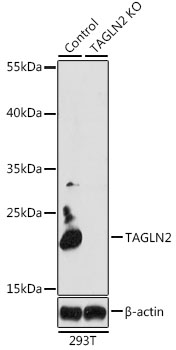 Western blot - TAGLN2 Polyclonal Antibody 