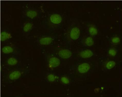 Immunocytochemistry staining of HeLa cells using MSH6 mouse mAb (dilution 1:100).