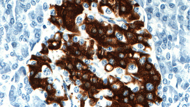 Immunohistochemistry of paraffin-embedded human pancreas tissue slide using Catalog No:107350(Insulin Antibody) at dilution of 1:5000 (under 40x lens).