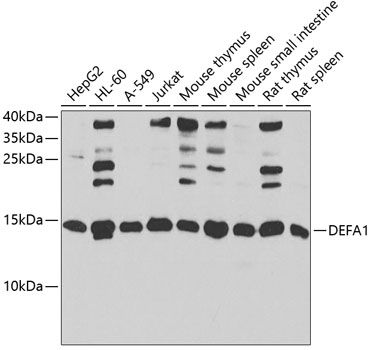 Western blot - DEFA1 Polyclonal Antibody 