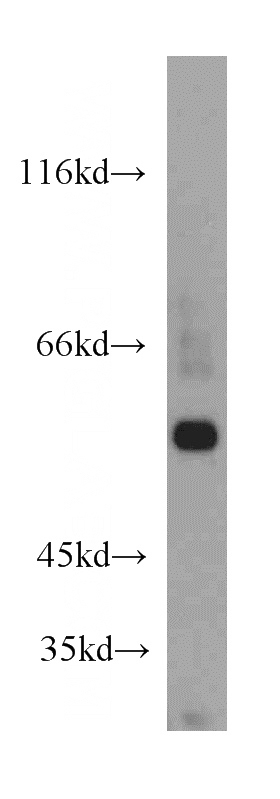 human heart tissue were subjected to SDS PAGE followed by western blot with Catalog No:107973(ALDH6A1 antibody) at dilution of 1:300