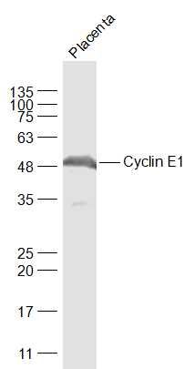 Fig8: Sample:; Placenta (Mouse) Lysate at 40 ug; Primary: Anti-Cyclin E1 at 1/1000 dilution; Secondary: IRDye800CW Goat Anti-Rabbit IgG at 1/20000 dilution; Predicted band size: 45 kD; Observed band size: 48 kD