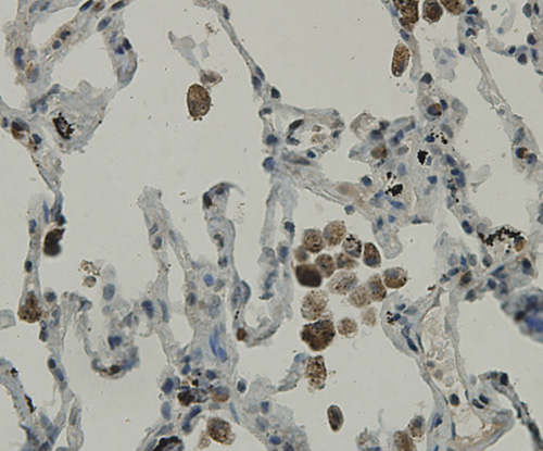 Fig6: Immunohistochemical analysis of paraffin-embedded human lung tissue using anti-C19orf35 antibody. Counter stained with hematoxylin.