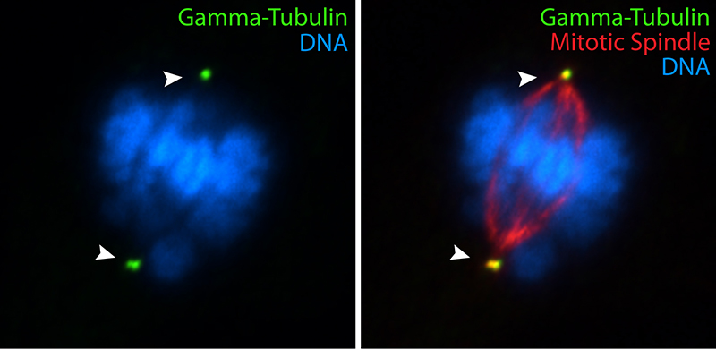IF results of gamma tubulin antibody (Catalog No:110859, 1:100) with hTERT-RPE cells by Moshe Kim (laboratory of Dr. William S Trimble, University of Toronto). Cells were fixed in ice-cold methanol.