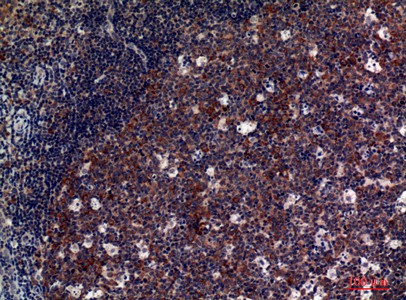 Fig2:; Immunohistochemical analysis of paraffin-embedded human-tonsils, antibody was diluted at 1:100