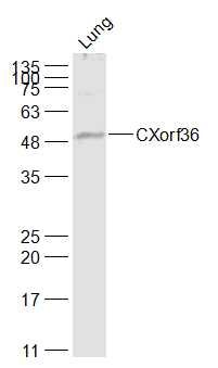 Fig4: Sample:; Lung (Mouse) Lysate at 40 ug; Primary: Anti-CXorf36 at 1/1000 dilution; Secondary: IRDye800CW Goat Anti-Rabbit IgG at 1/20000 dilution; Predicted band size: 45 kD; Observed band size: 50 kD