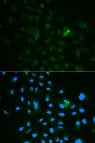 Immunofluorescence - CD79B Polyclonal Antibody 
