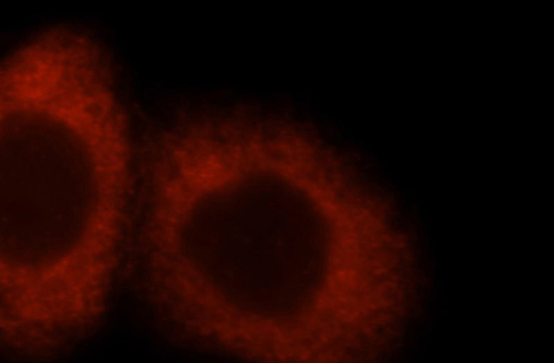 Immunofluorescent analysis of Hela cells, using IMPDH2 antibody Catalog No:111786 at 1:25 dilution and Rhodamine-labeled goat anti-rabbit IgG (red).