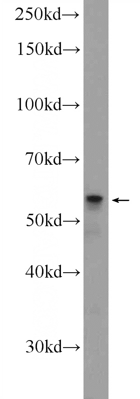 K-562 cells were subjected to SDS PAGE followed by western blot with Catalog No:110931(GDPD5 Antibody) at dilution of 1:300