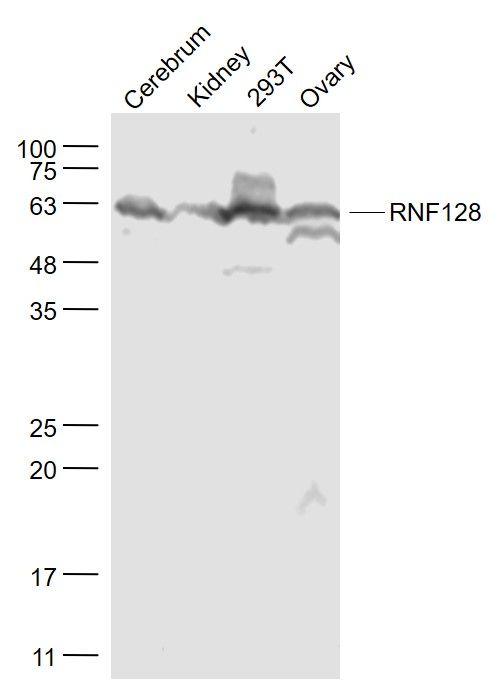 Fig4: Sample:; Cerebrum (Mouse) Lysate at 40 ug; Kidney (Mouse) Lysate at 40 ug; 293T(Human) Cell Lysate at 30 ug; Ovary (Mouse) Lysate at 40 ug; Primary: Anti- RNF128 at 1/1000 dilution; Secondary: IRDye800CW Goat Anti-Rabbit IgG at 1/20000 dilution; Predicted band size: 43 kD; Observed band size: 62 kD